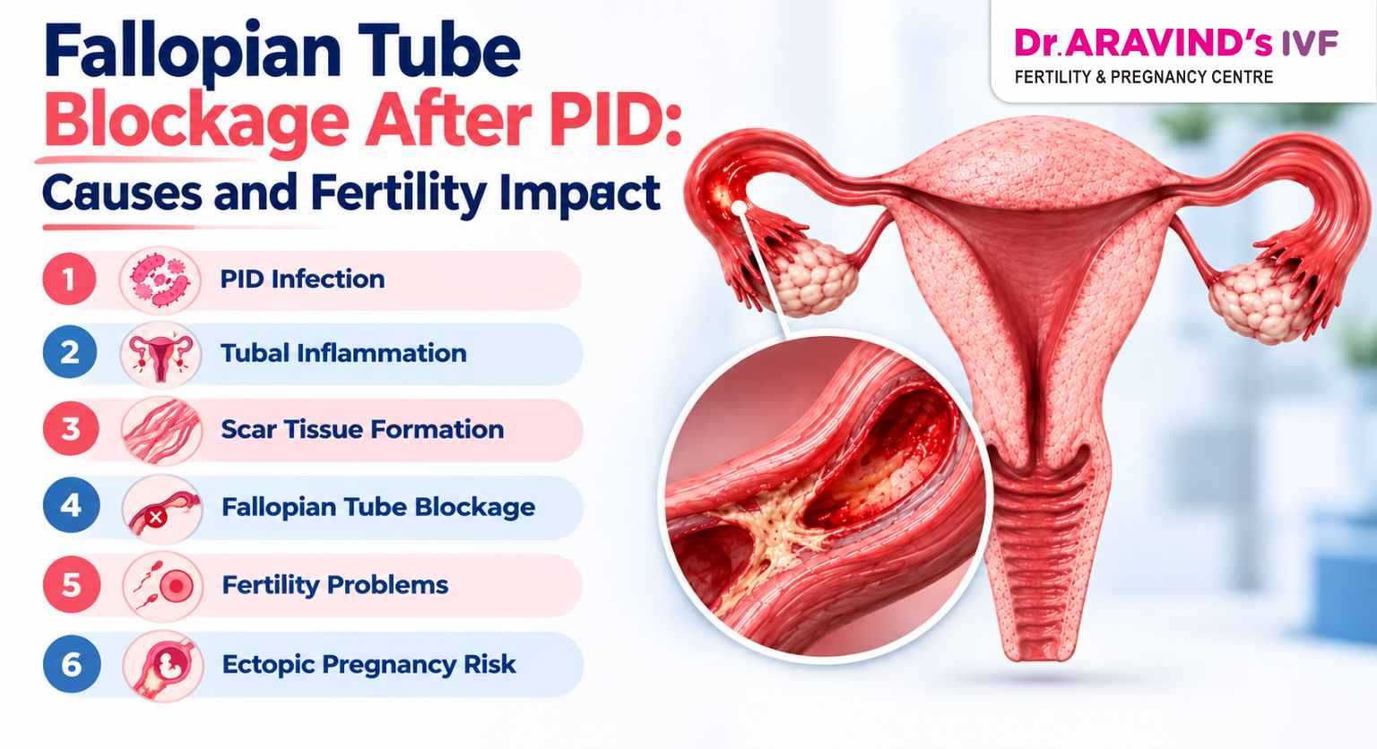 Fallopian tube blockage causes after PID affecting fertility