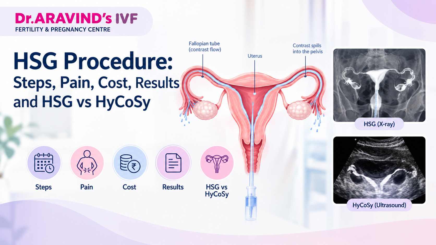 HSG procedure showing uterus and fallopian tubes with HSG X-ray and HyCoSy comparison