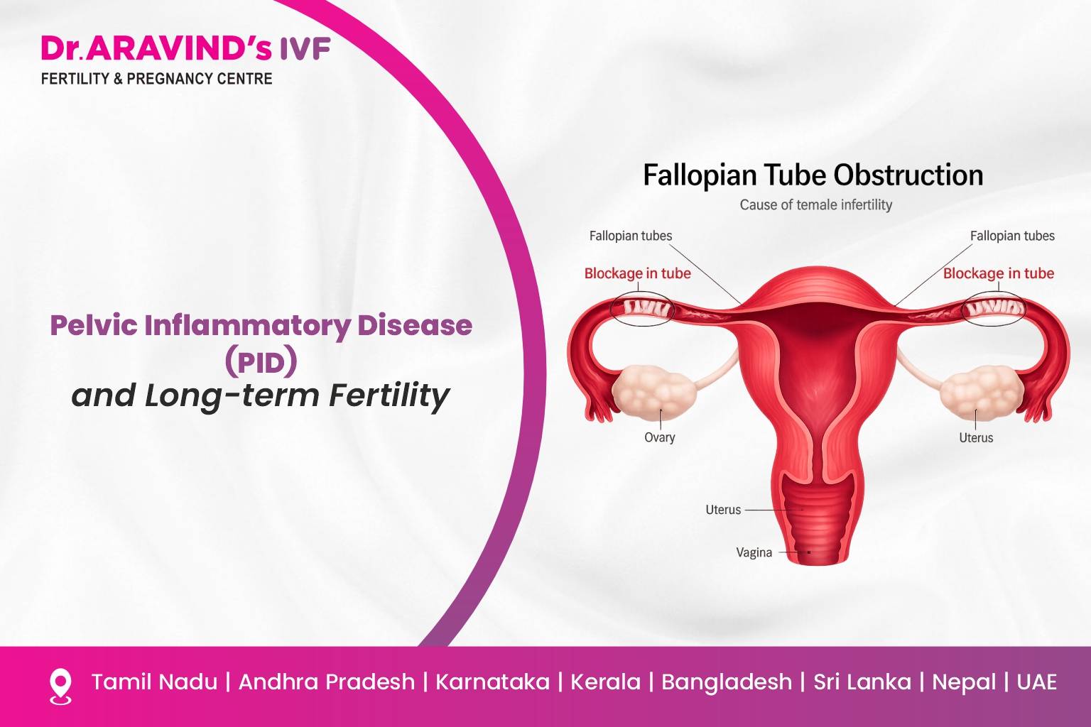 Pelvic inflammatory disease diagram showing fallopian tube damage